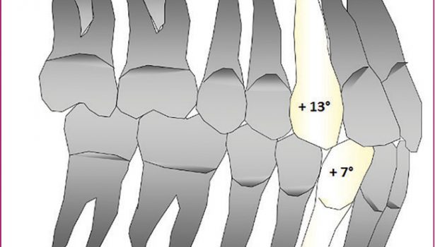 OWP_4_19_LECZENIE_LEKKIEJ_WADY_ZGRYZU_KLASY_III_RYS_1_A