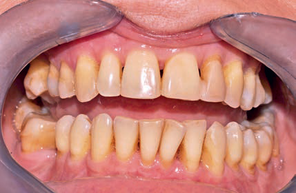 Kompleksowe leczenie