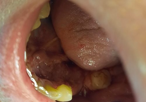 Poziom metali ciężkich