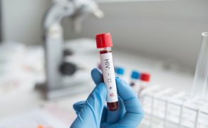 HIV; fot. iStock