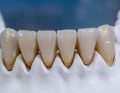 zasady szlifowania zębów ; fot. iStock