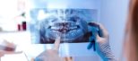 zdjęcie pantomograficzne; fot. iStock