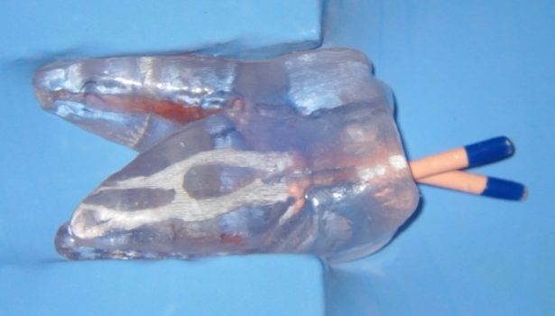 Uszczelniacze bioceramiczne