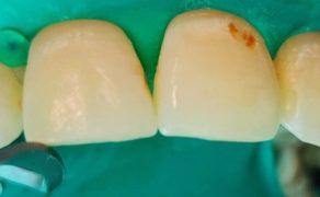 Fot. 4. Przypadek 2: stan wyjściowy; fot. archiwum autorki