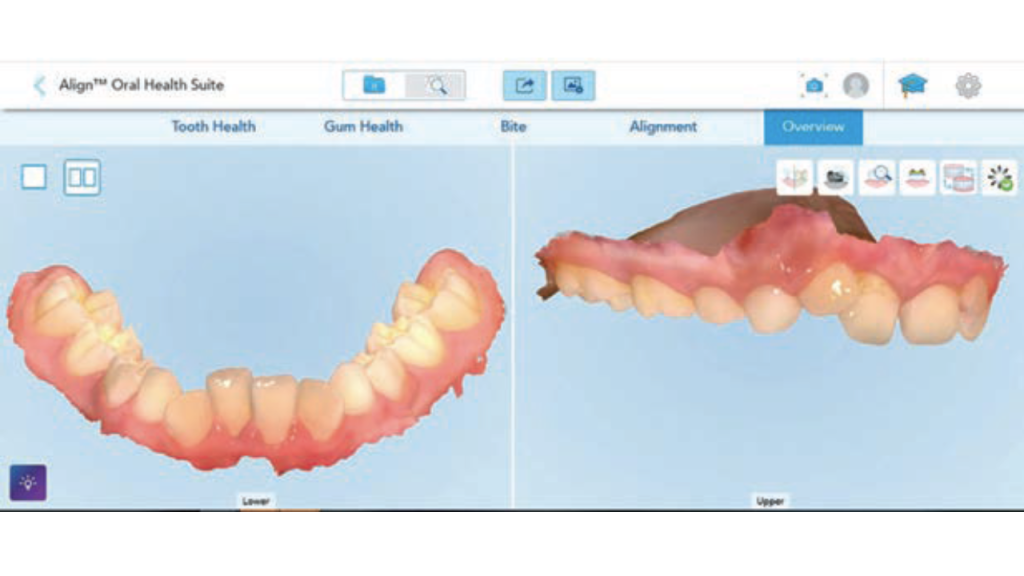ekspansja szkieletowa