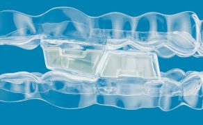 Mandibular Advancement
