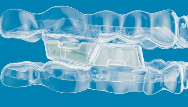 Mandibular Advancement