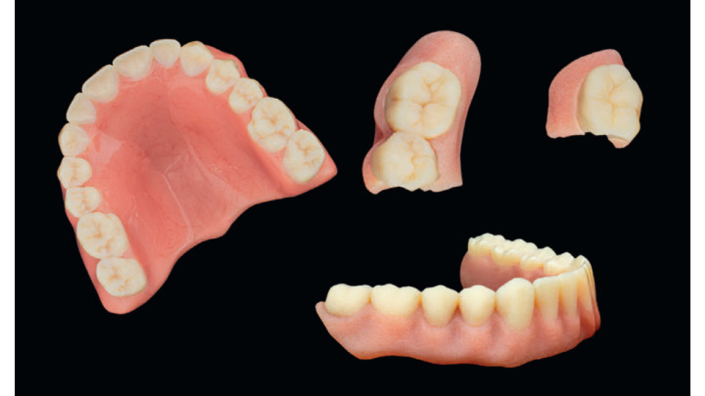 Fot. 10. Gotowe protezy z druku 3D oparte na indywidualnie dopasowanym projekcie w EXOCAD