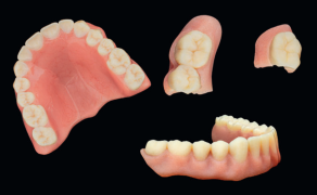 Fot. 10. Gotowe protezy z druku 3D oparte na indywidualnie dopasowanym projekcie w EXOCAD