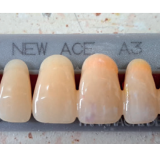 indywidualna charakteryzacja protez