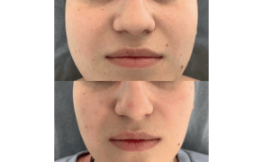 Medycyna estetyczna w stomatologii