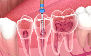 Środki chemiczne; fot. iStock