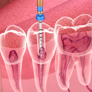 Środki chemiczne; fot. iStock