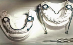 Ryc. 5. Uproszczona konstrukcja aparatu Herbsta