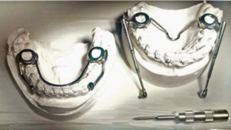 Ryc. 5. Uproszczona konstrukcja aparatu Herbsta