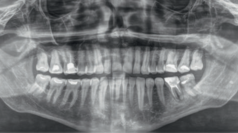 Fot. 1. Zdjęcie OPG