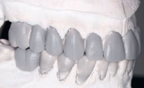 Fot. 6b. Nawoskowanie diagnostyczne w CR