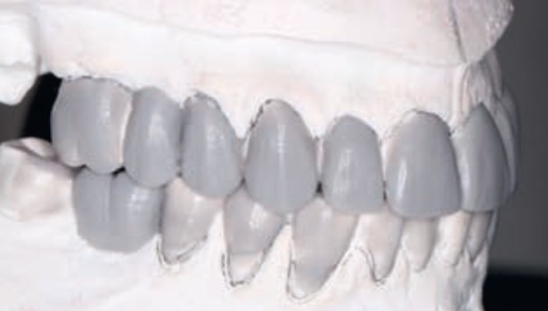 Fot. 6b. Nawoskowanie diagnostyczne w CR