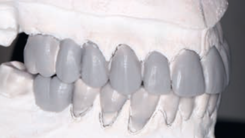 Fot. 6b. Nawoskowanie diagnostyczne w CR