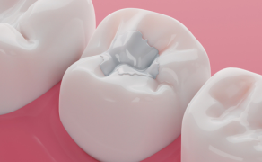 stosowanie kompozytów; fot. iStock