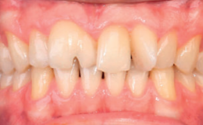 Zachowawcze interdyscyplinarne postepowanie