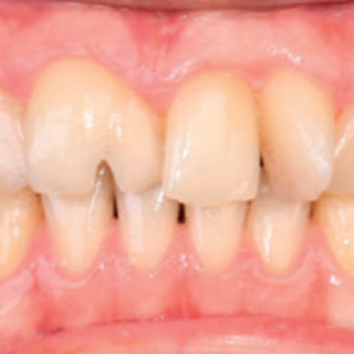 Zachowawcze interdyscyplinarne postepowanie