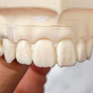 Fot. 1. Pęknięcia w modelu powstałe wzdłuż warstw druku