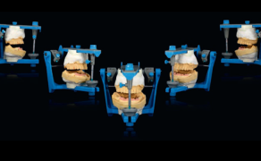 Nowa granica protetyki