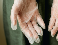 reakcje alergiczne; fot. iStock