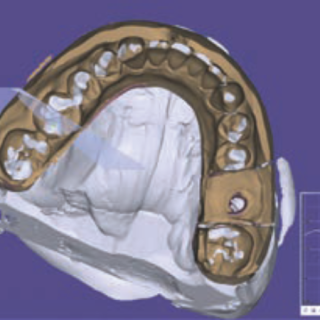 Najczęstsze błędy w skanach