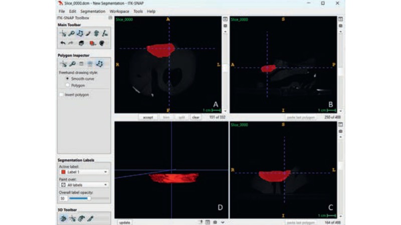 Ocena in vitro